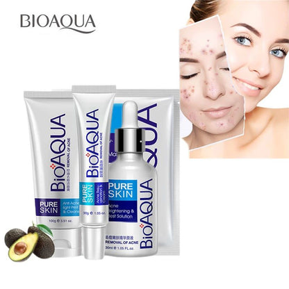 🎀¡ELIMINA EL ACNÉ DE TU VIDA! Te traemos la solución, kit completo Bioaqua, nutre, limpia y suaviza tu piel🎀